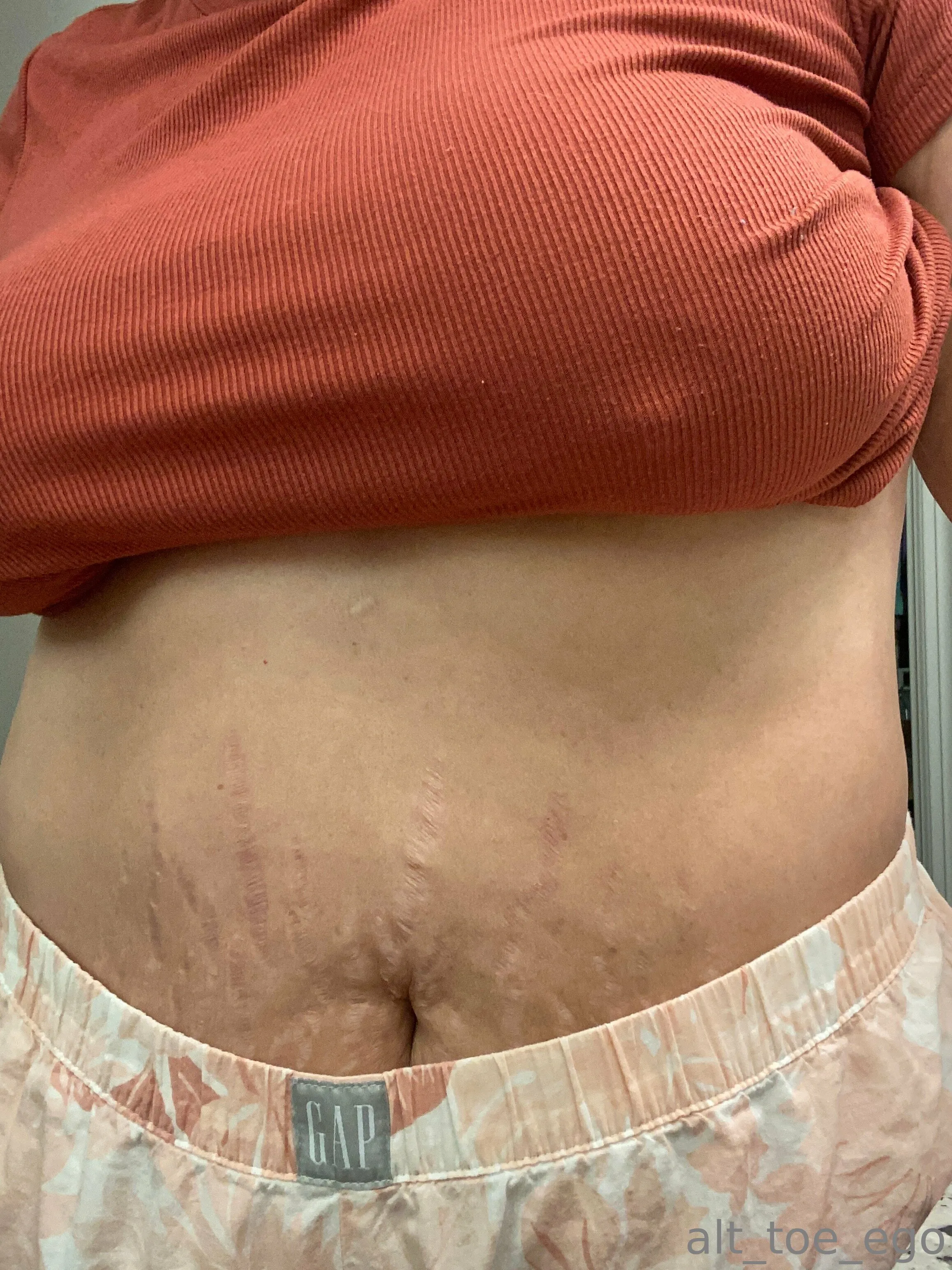 Daily Cup Of Toe OnlyFans free account photo 4 - alt_toe_ego nudes and sex tapes